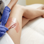 Waarom Sugaring De Beste Ontharingsmethode Is